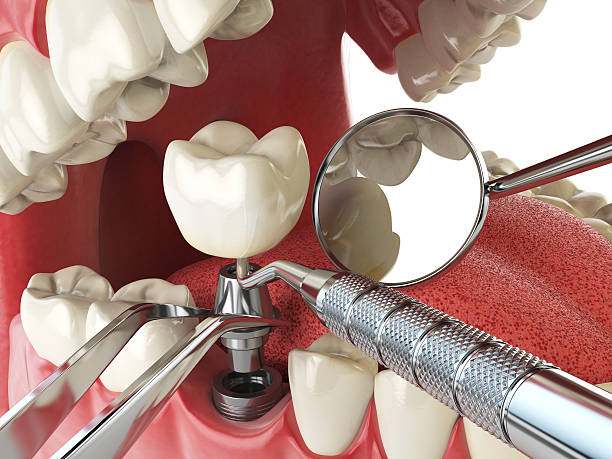 Best Orthodontic Emergency Dentist in Annandale, VA